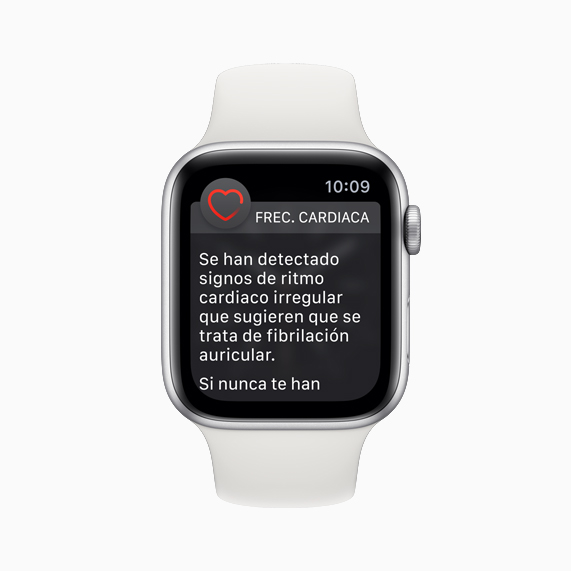 Esfera del Apple Watch con una notificación de ritmo cardiaco irregular.