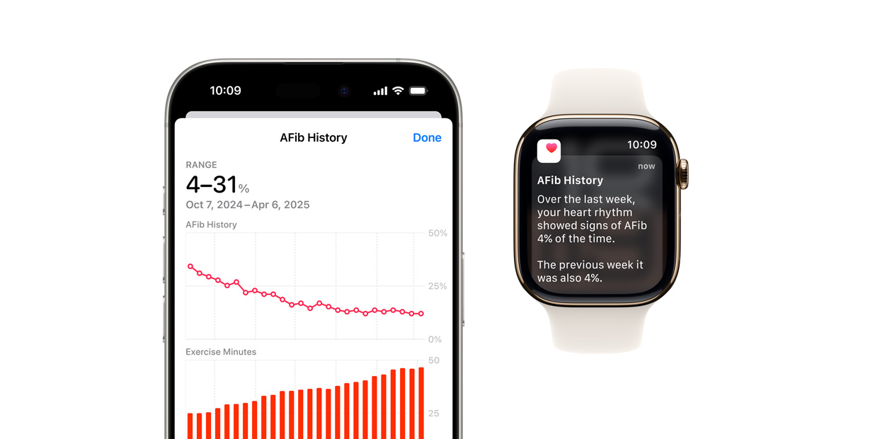 Ph?n m?m hi?n th? ?ng d?ng L?ch s? AFib trên iPhone và th?ng báo trên Apple Watch.
